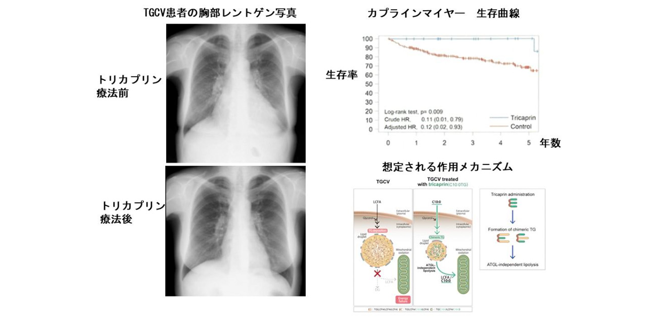 トリカプリン療法が 中性脂肪蓄積心筋血管症(TGCV)患者の 生存率向上、心不全の顕著な改善に寄与する